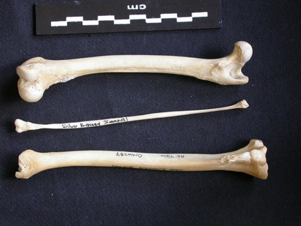 Fémur, tibia et fibula