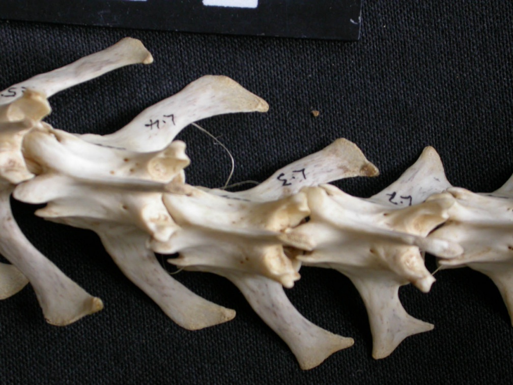 Vertèbres lombaires