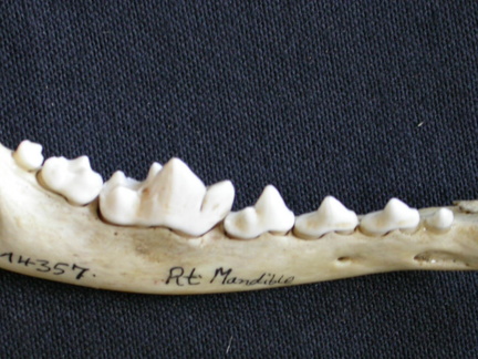 Lower teeth