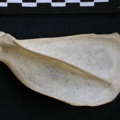 Scapula : vue latérale