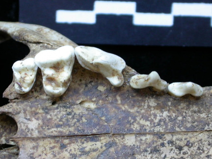 Dentition supérieure