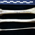 Fémur, tibia et fibula