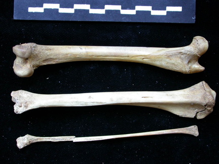  Femur, tibia and fibula