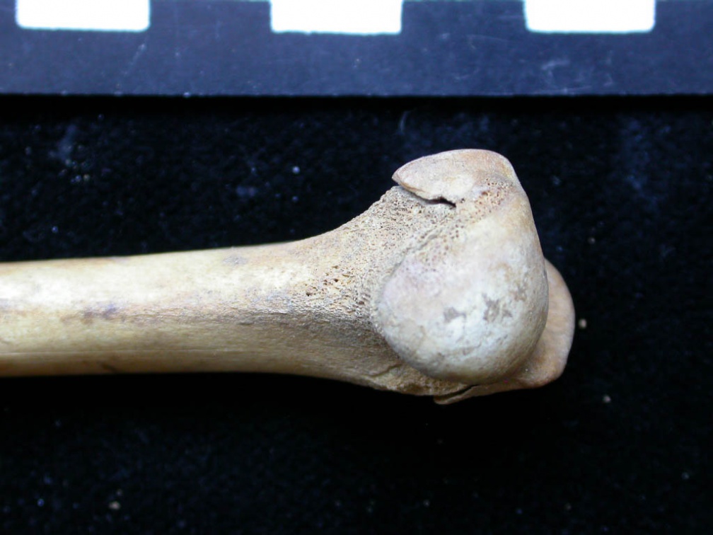 Húmero : parte proximal