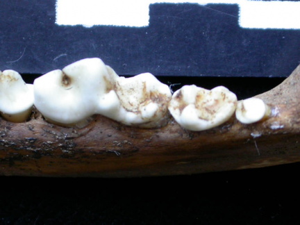 Dentition inférieure