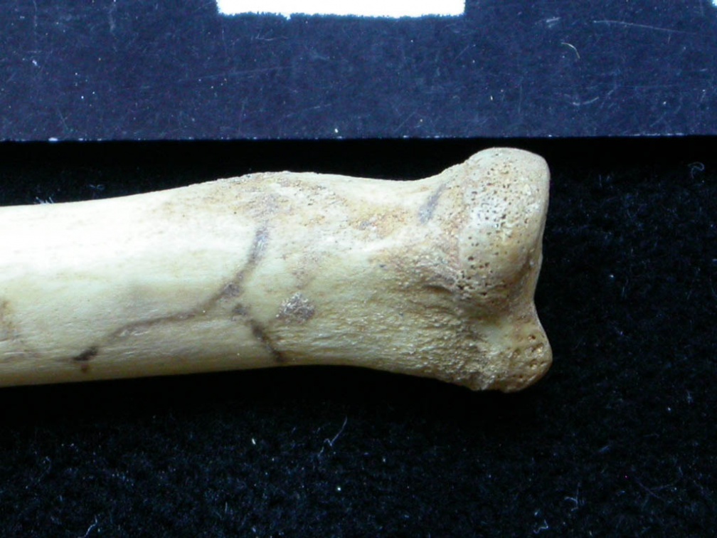 Radius : partie proximale