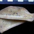 Scapula : vue latérale