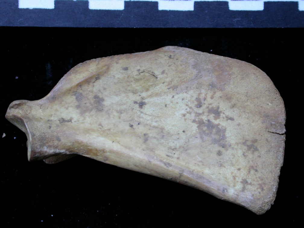 Scapula: medial view