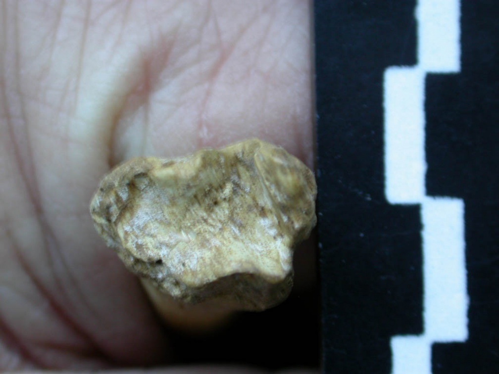 Tibia : partie distale