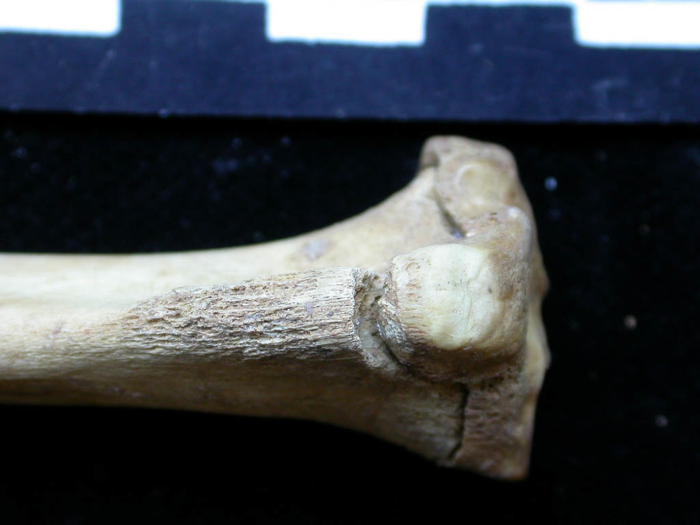  Tibia: proximale part