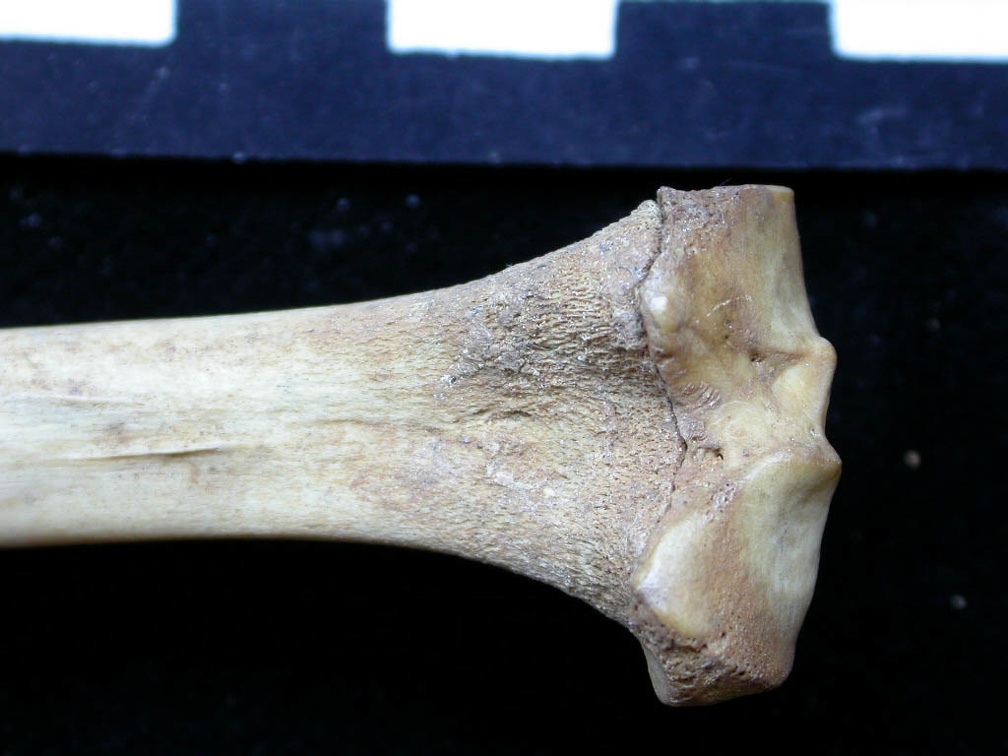  Tibia: proximale part