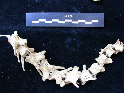 Vertebrae