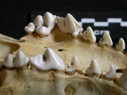 Dentition supérieure