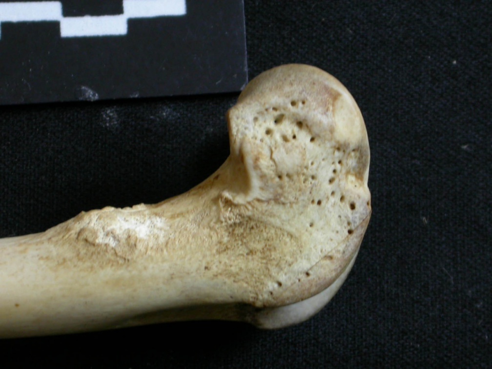 Fémur : partie distale