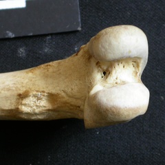 Femur: distal part