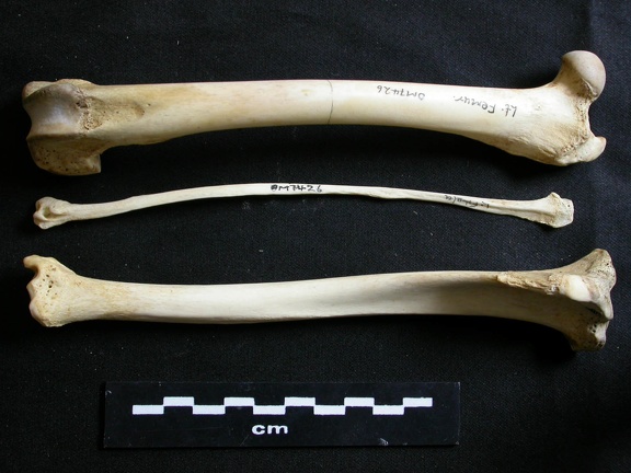  Fémur, tibia y fíbula