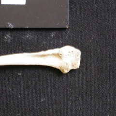 Fibula: proximale part