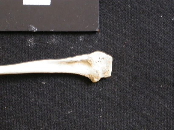 Fibula : partie proximale