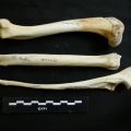 Humérus, radius et ulna