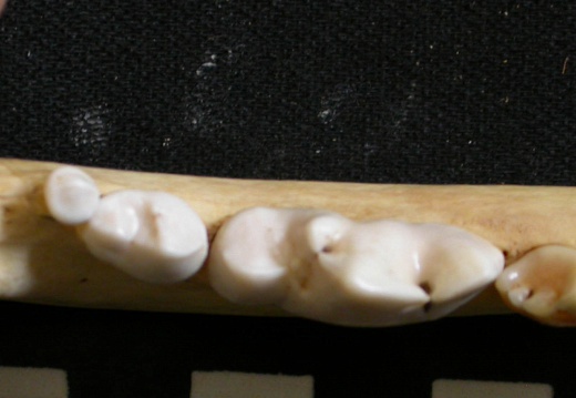 Dentition inférieure