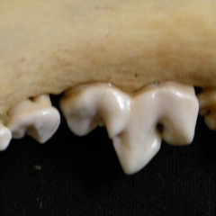 Lower teeth