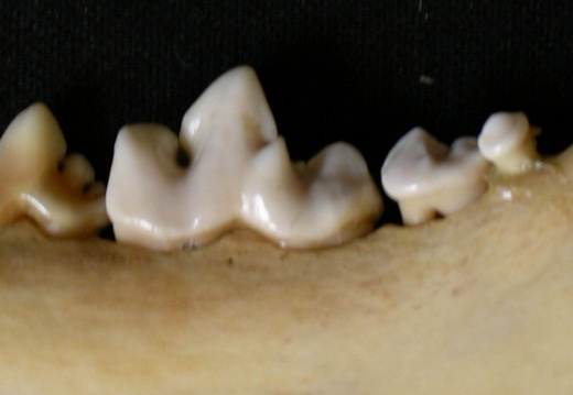 Dentition inférieure