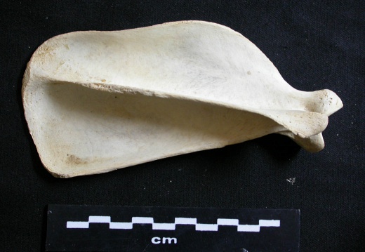 Scapula : vue latérale