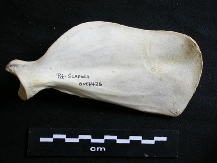 Scapula : vue médiale