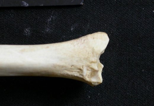  Tibia: distal part