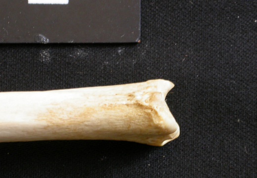  Tibia: distal part