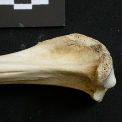  Tibia: proximale part