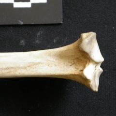  Tibia: proximale part