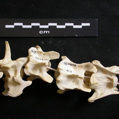 Cervical vertebrae