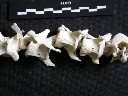 Cervical vertebrae