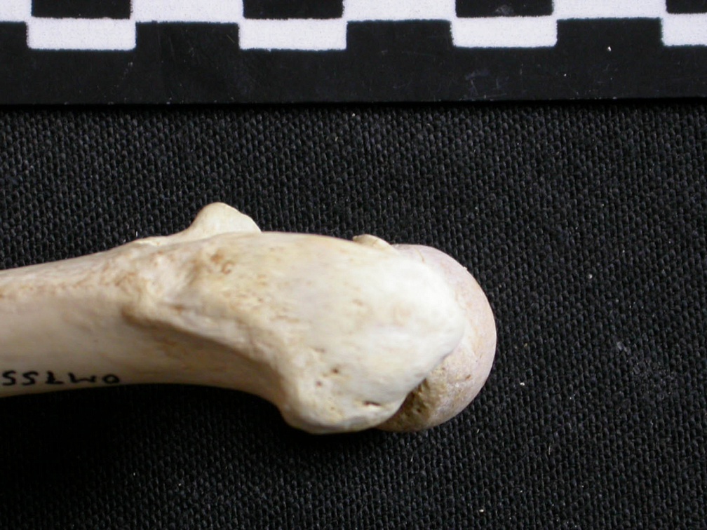 Femur: proximale part