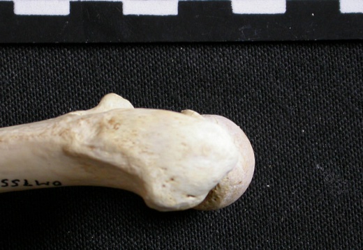 Femur: proximale part