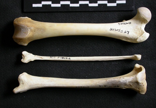  Femur, tibia and fibula