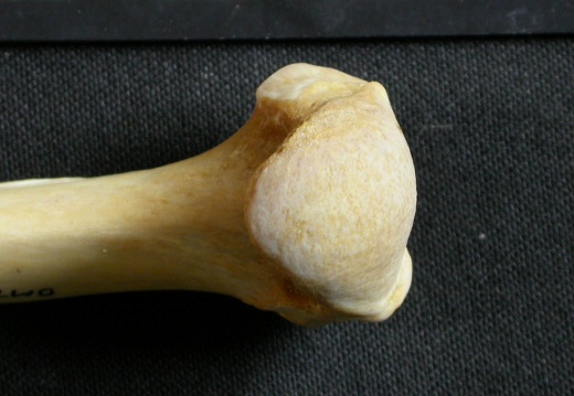 Humerus: proximale part