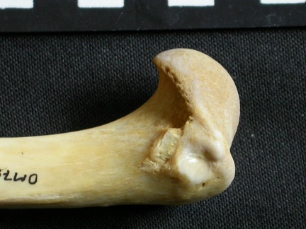 Humerus: proximale part