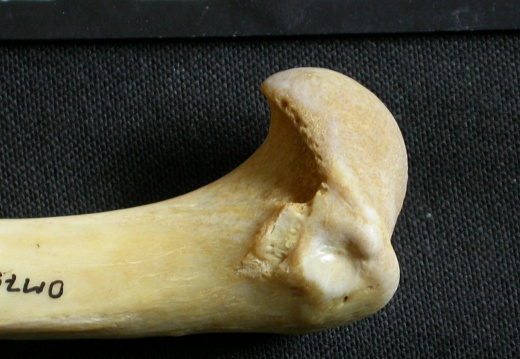 Humerus: proximale part