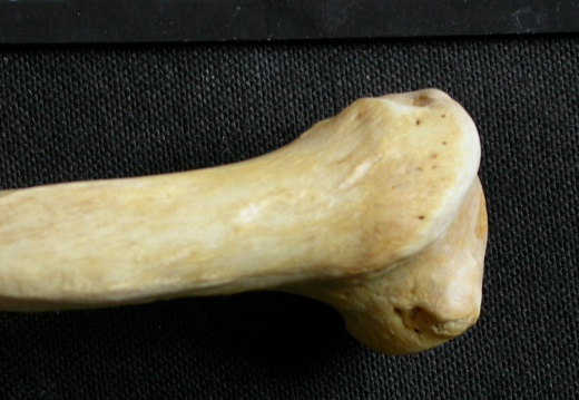 Humerus: proximale part