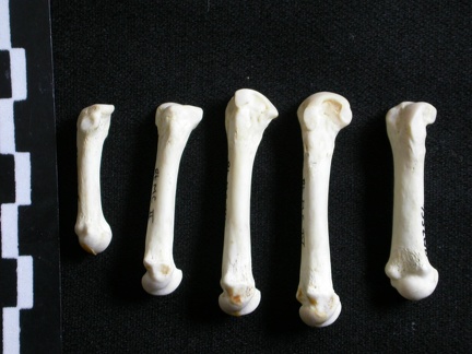 Metacarpals