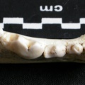 Dentition inférieure