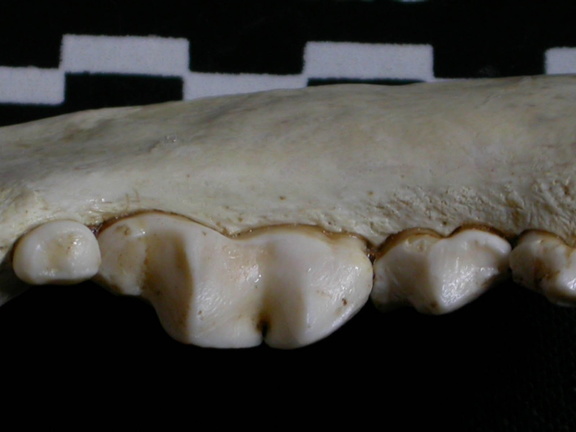 Dentition inférieure