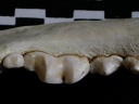 Dentition inférieure