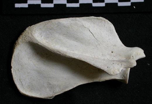 Scapula : vue latérale