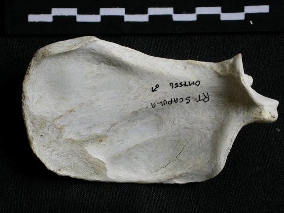 Scapula: medial view