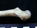 Femur: proximale part
