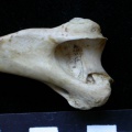 Humerus: distal part