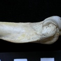 Humerus: distal part